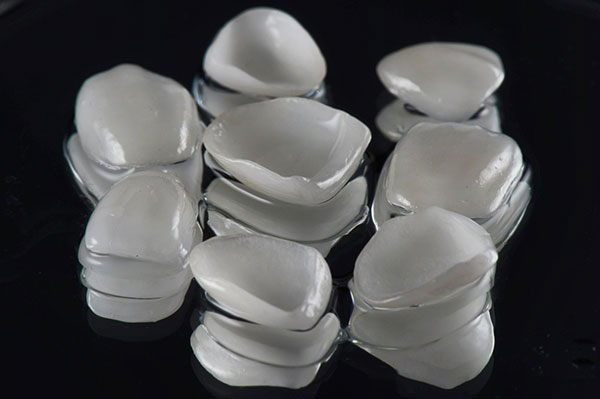 Porcelain/Ceramic Veneers
